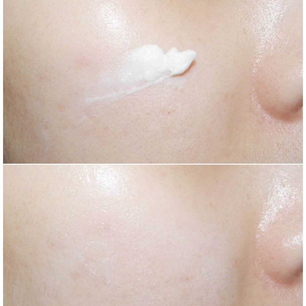 Korea Mizon Skin Recovery Nigh - Luxury Skincare In Korea recension och pris